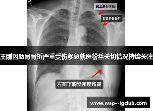 王刚因肋骨骨折严重受伤紧急就医粉丝关切情况持续关注 王刚因肋骨骨折严重受伤紧急就医粉丝关切情况持续关注